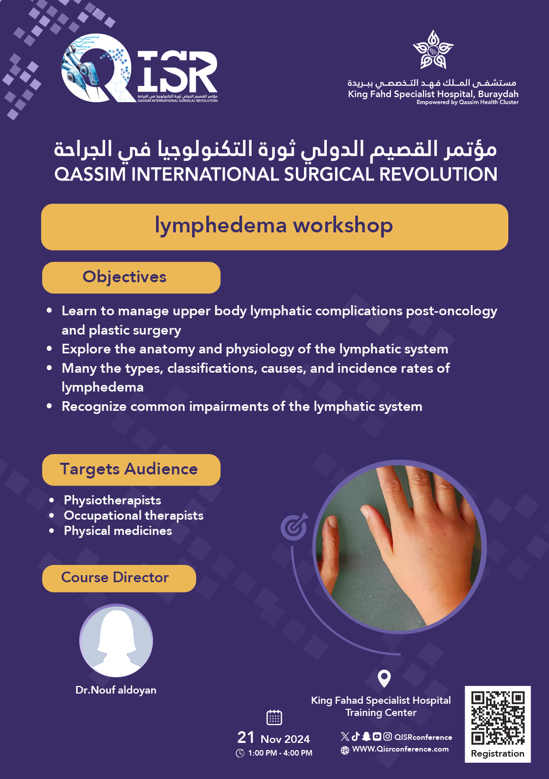 lymphedema